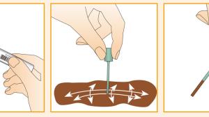 2. Desenrosque el tapón verde con el bastoncillo para la recogida. Pinche con la varilla en las heces en distintos lugares y con diferentes ángulos. Los surcos del bastoncillo deben ser cubiertos por heces. Es suficiente con poca cantidad de muestra. Recogida de muestra con el hisopo