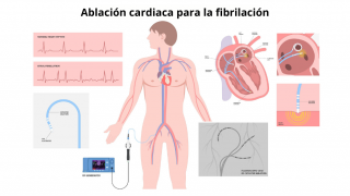 gráficos del ritmo cardiaco a la izquierda, imagen prediseñada de hombre con corazón y sistema circulatorio en el centro, a la izquierda corazón