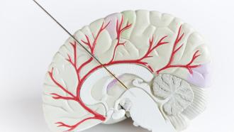 imagen prediseñada de un cerebro en 3d color blanco con los nervios en rojo y una especie de punzón que toca la parte lateral