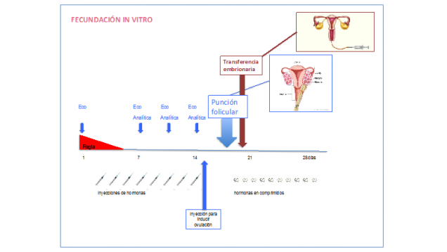 Ciclo de fecundación in vitro