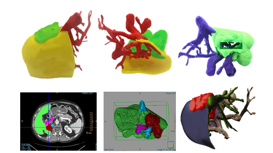 Biomodelo impreso en PLA, segmentación y modelo 3D virtual