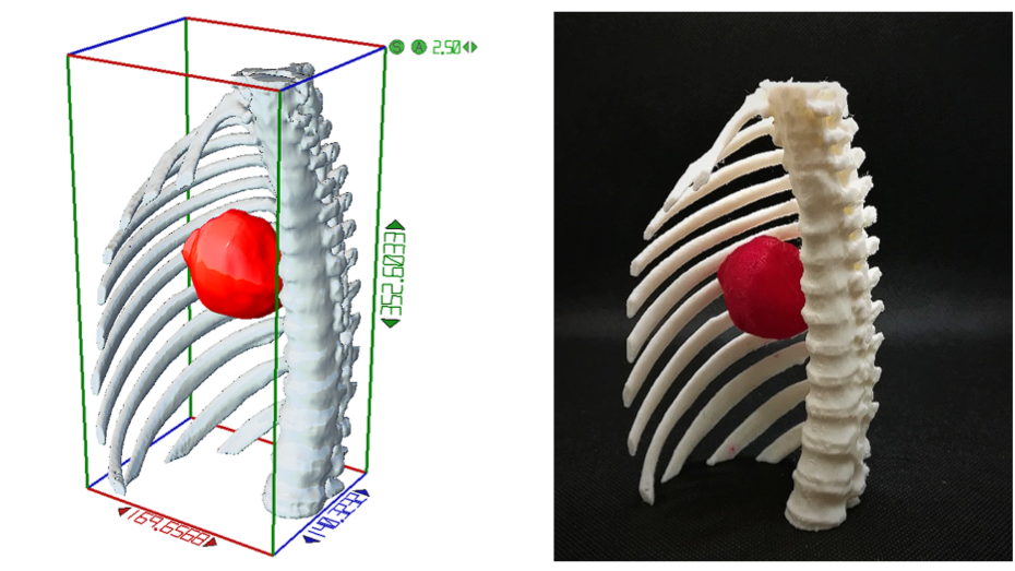 Modelo virtual y biomodelo impreso en ASA y TPU fabricado mediante impresión 3D