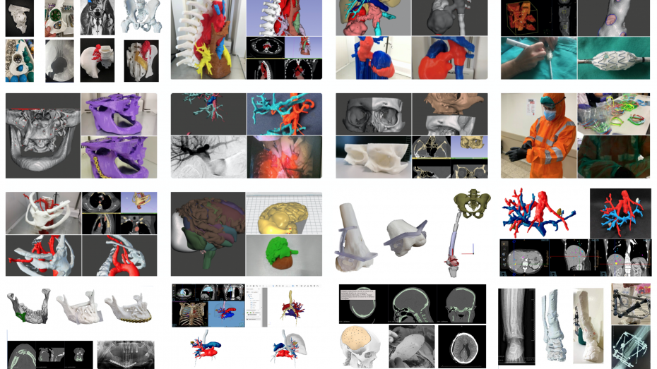 Imágenes miniatura con ejemplos de casos de la Unidad 3D