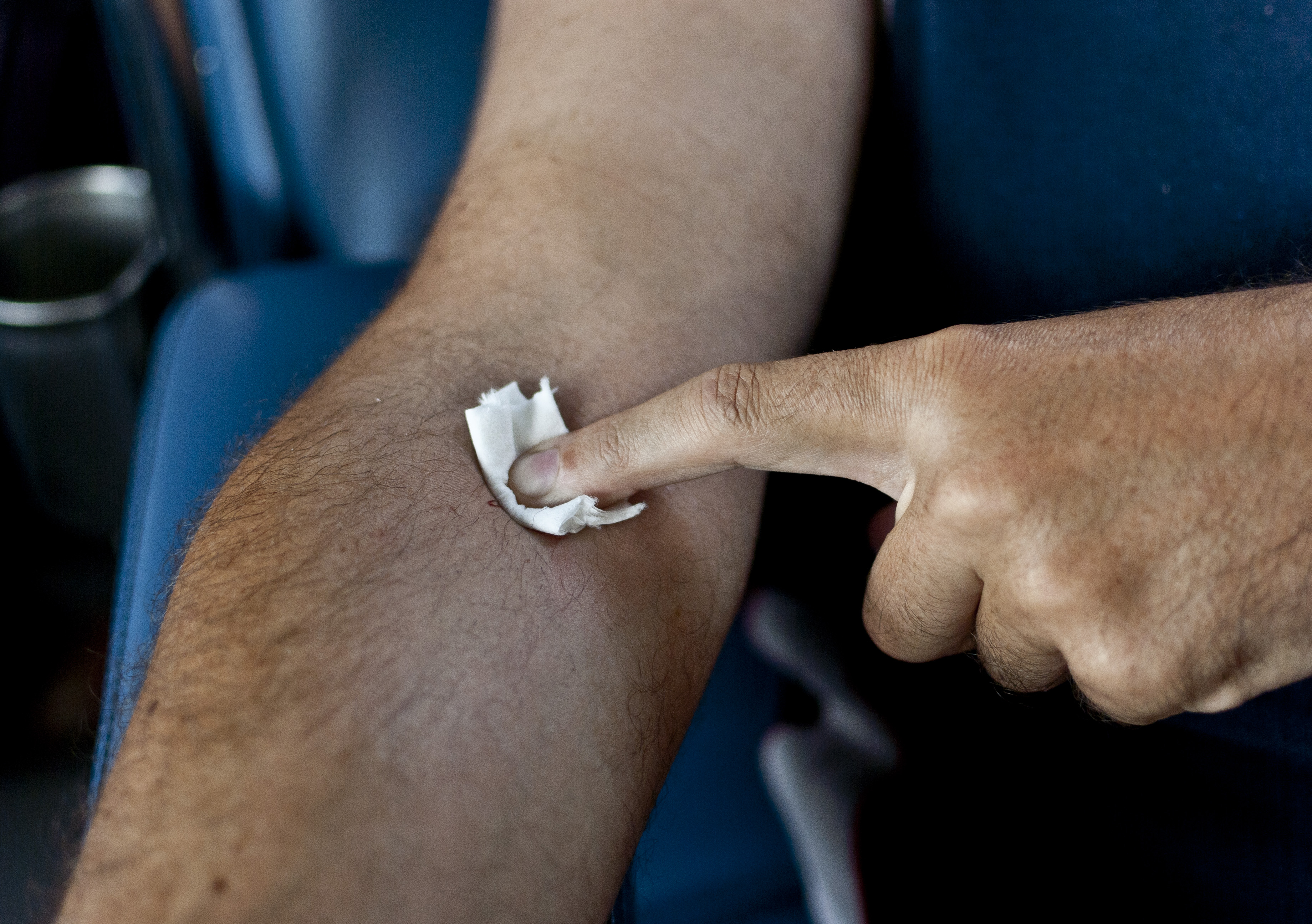Ejerciendo presión sobre el pinchazo tras la donación de sangre