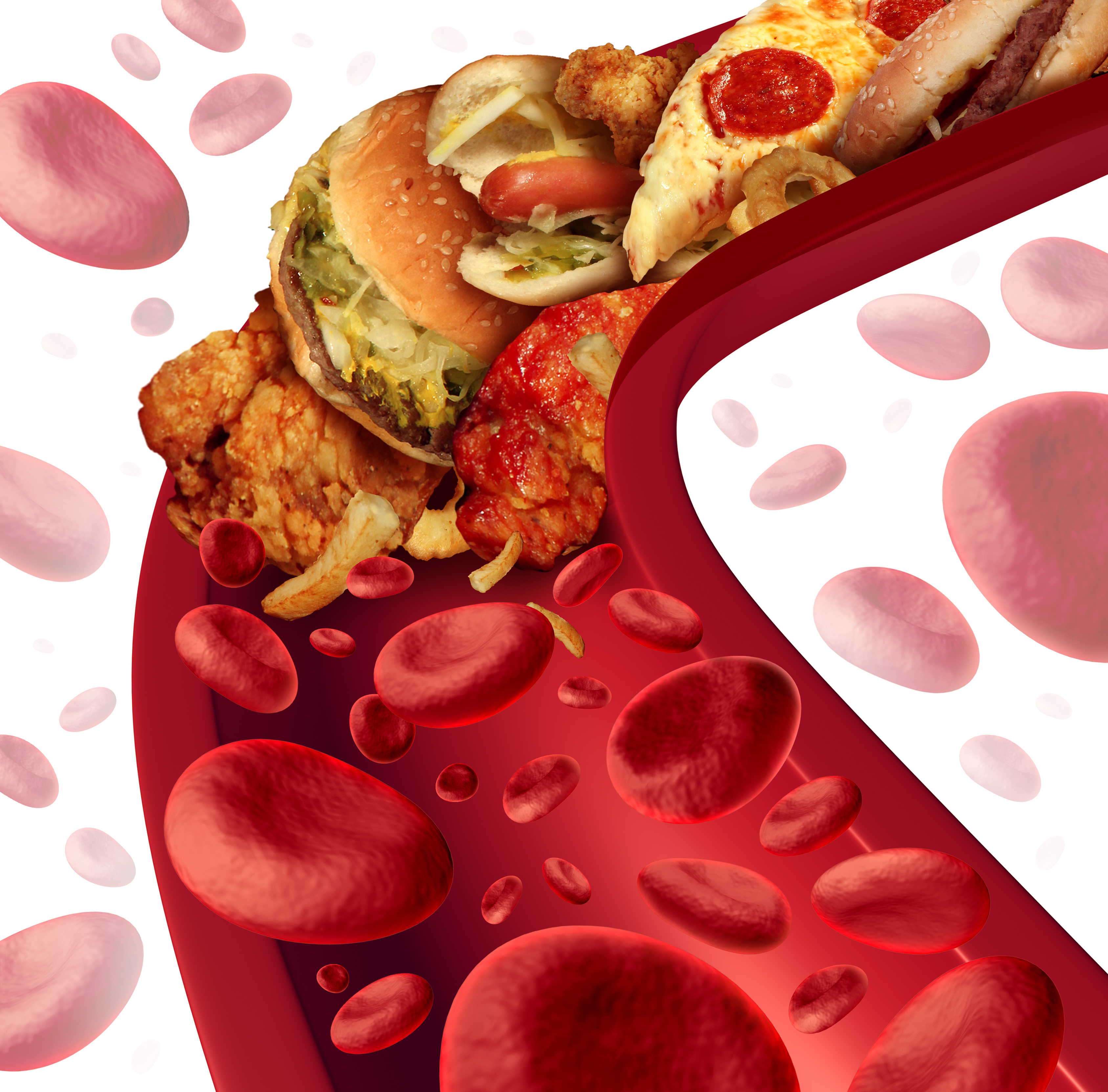 Imagen figurada de una arteria llena de comida basura