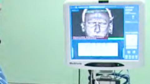 Cirugía endoscopia nasosinusal Dos profesionales médicoa mirando una pantalla con una imagen de un cabeza