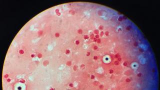 Cryptococcus neoformans. Hongo
