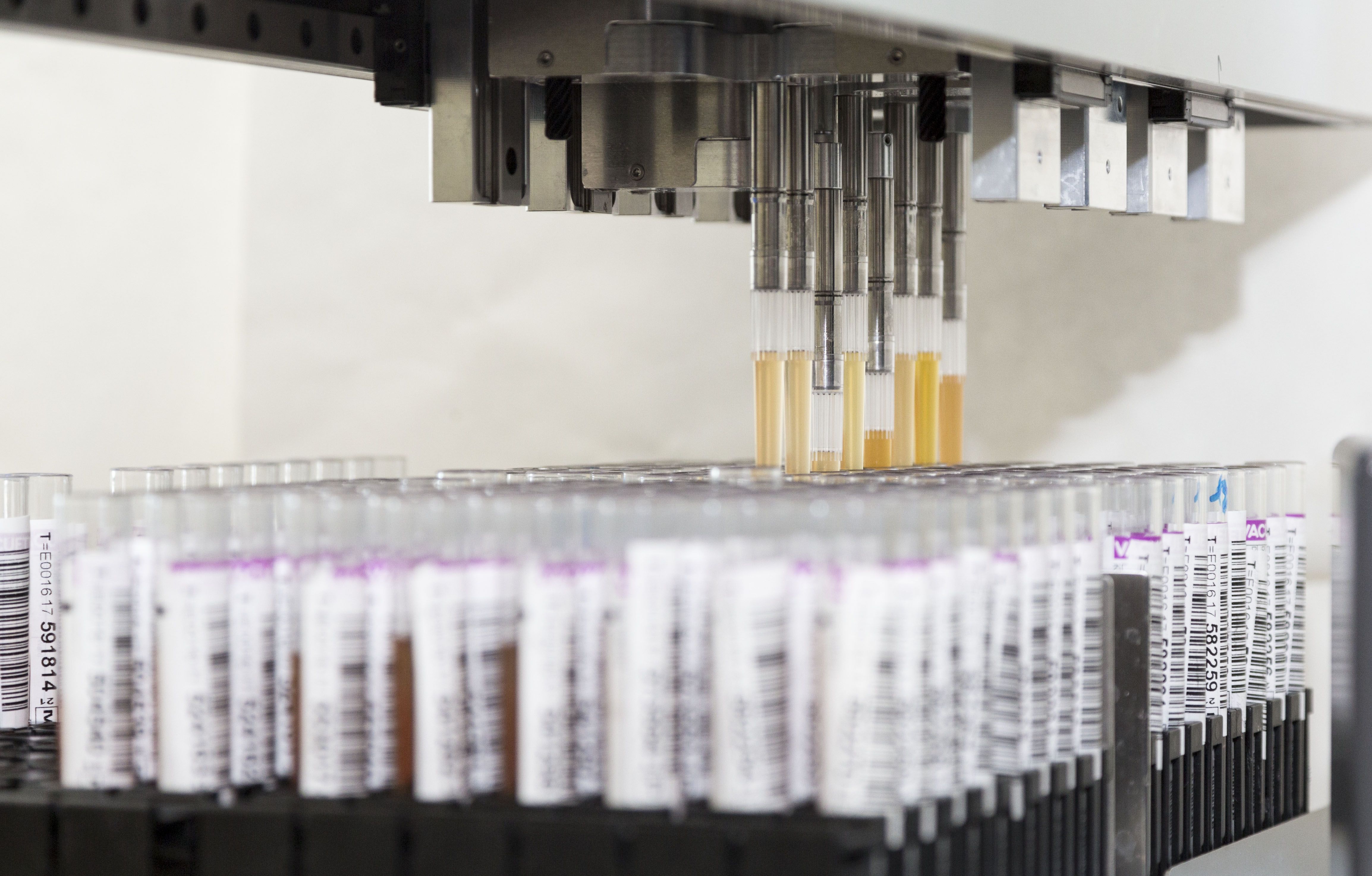 Diferentes tubos en laboratorio preparados para realizar un análisis de serología