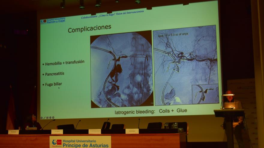 La jornada sirvió para abordar la coledocolitiasis desde todas las perspectivas posibles