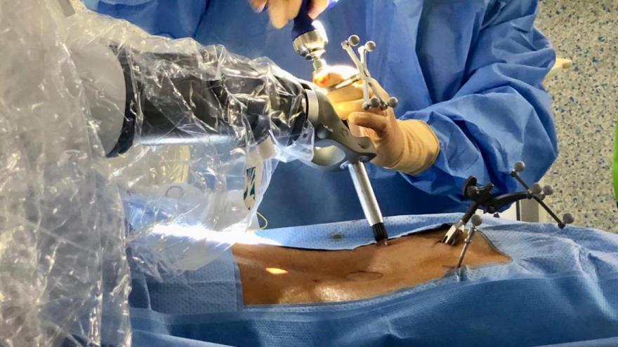 Cirugía robótica de columna en el Hospital Clínico San Carlos