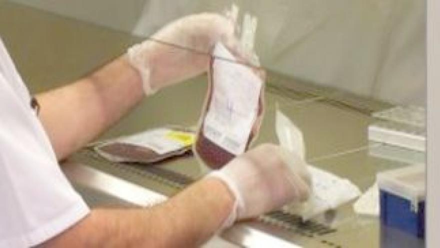 Sangre de cordón procesada en laboratorio