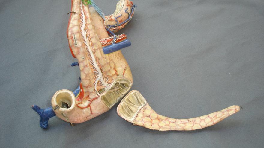 Pancreas with duodenum and jejunum