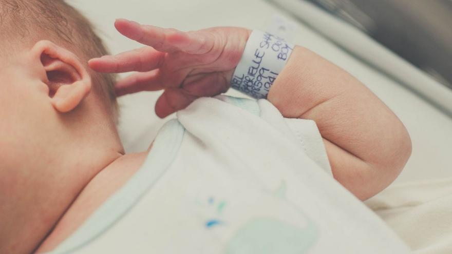 Bebé con defecto congénito de cuatro dedos en una mano
