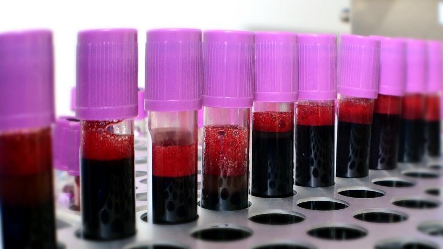 Muestras de sangre listas para ser analizadas