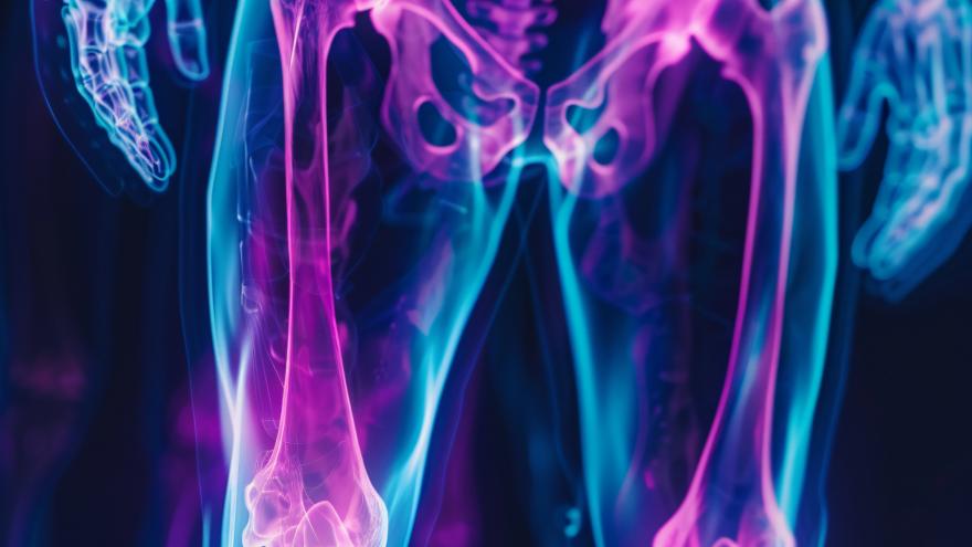 Premio Bone Alliance 2024 Hospital Universitario Infanta Leonor