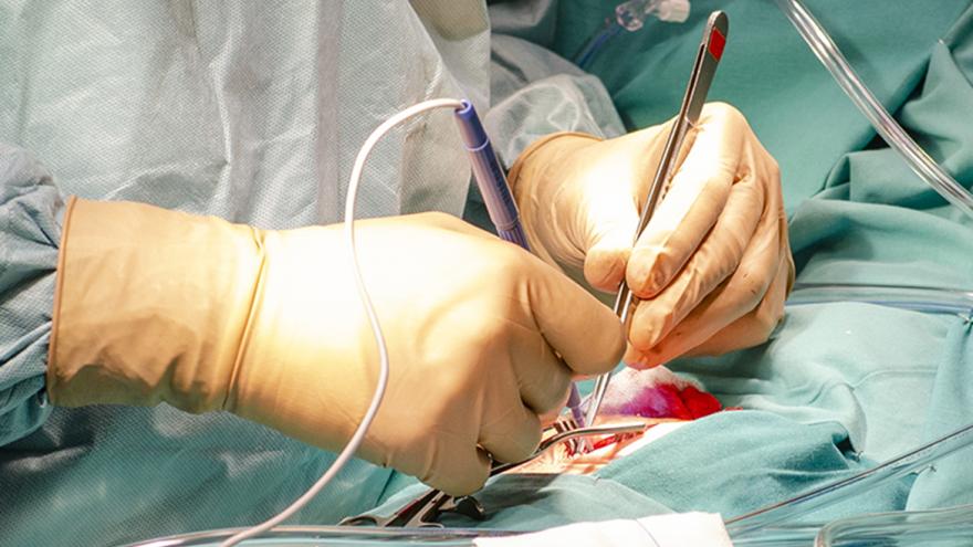 intervención quirúrgica