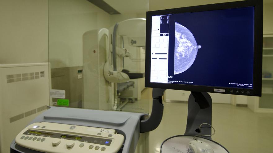 Imagen de un mamógrafo
