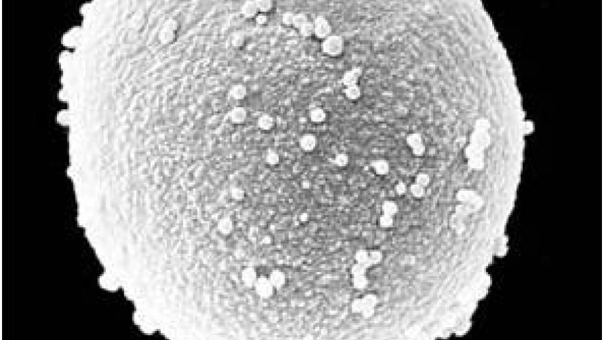 Imagen de grano de polen de Cupresaceae/Taxaceae (Cipreses y arizónicas)