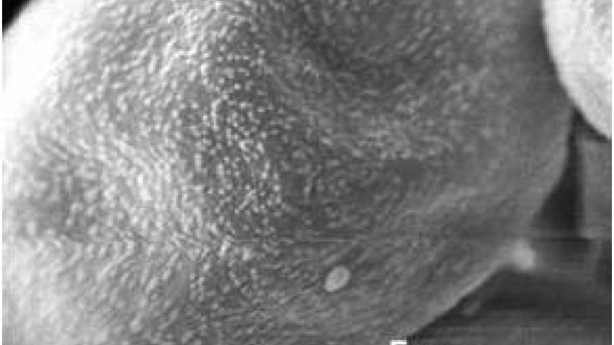 Imagen de grano de polen de Moraceae (morera) al microscopio electrónico