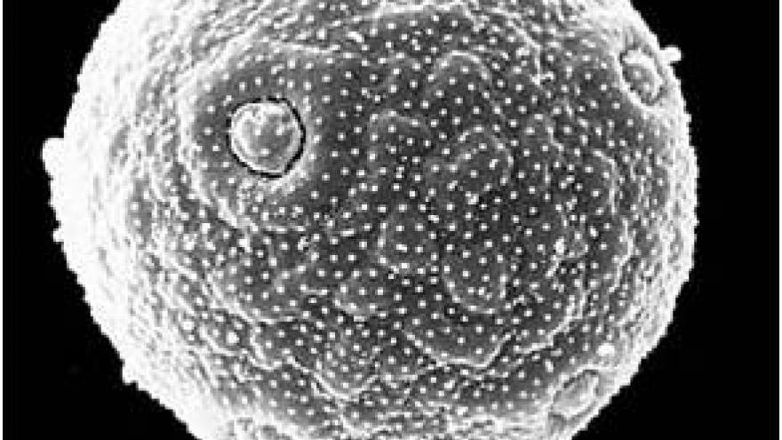 Imagen de grano de polen de Plantago al microscopio electrónico