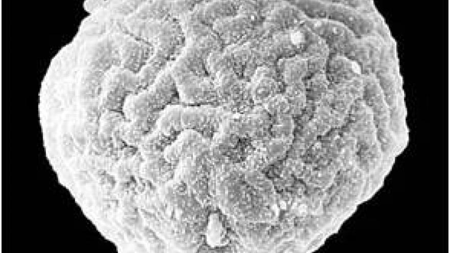Imagen de grano de polen de Ulmus (olmo) al microscopio electrónico