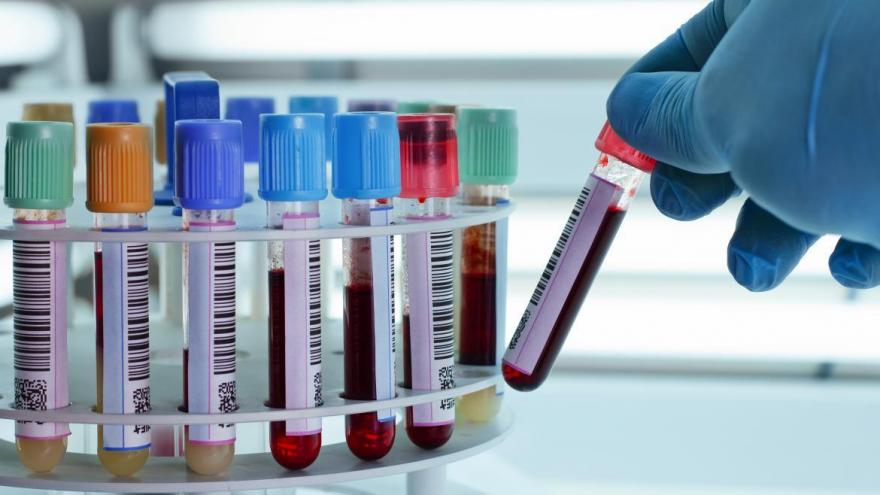 Tubos sanitarios con muestras de sangre