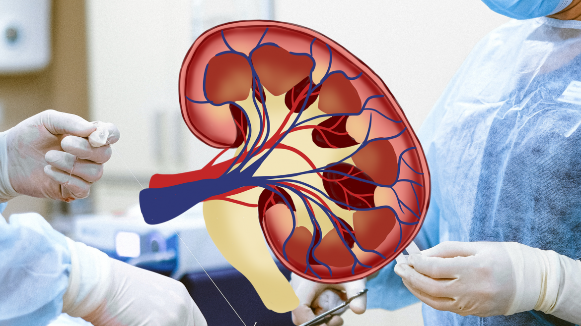 Imagen icónica de un riñón sobre un fondo de quirófano