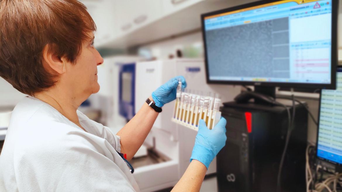 Imagen del artículo Bioquímica del Hospital Severo Ochoa explica la importancia de un análisis exhaustivo de orina para descartar o detectar patologías